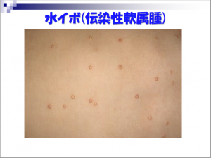 10kimura